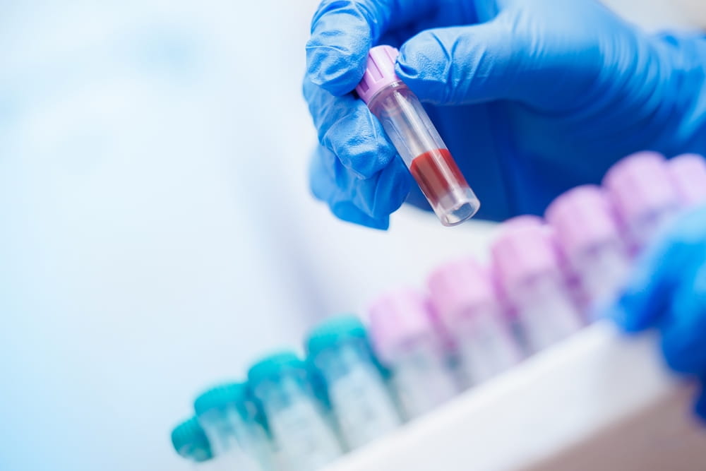 Blood test could predict best breast cancer treatment before therapy begins